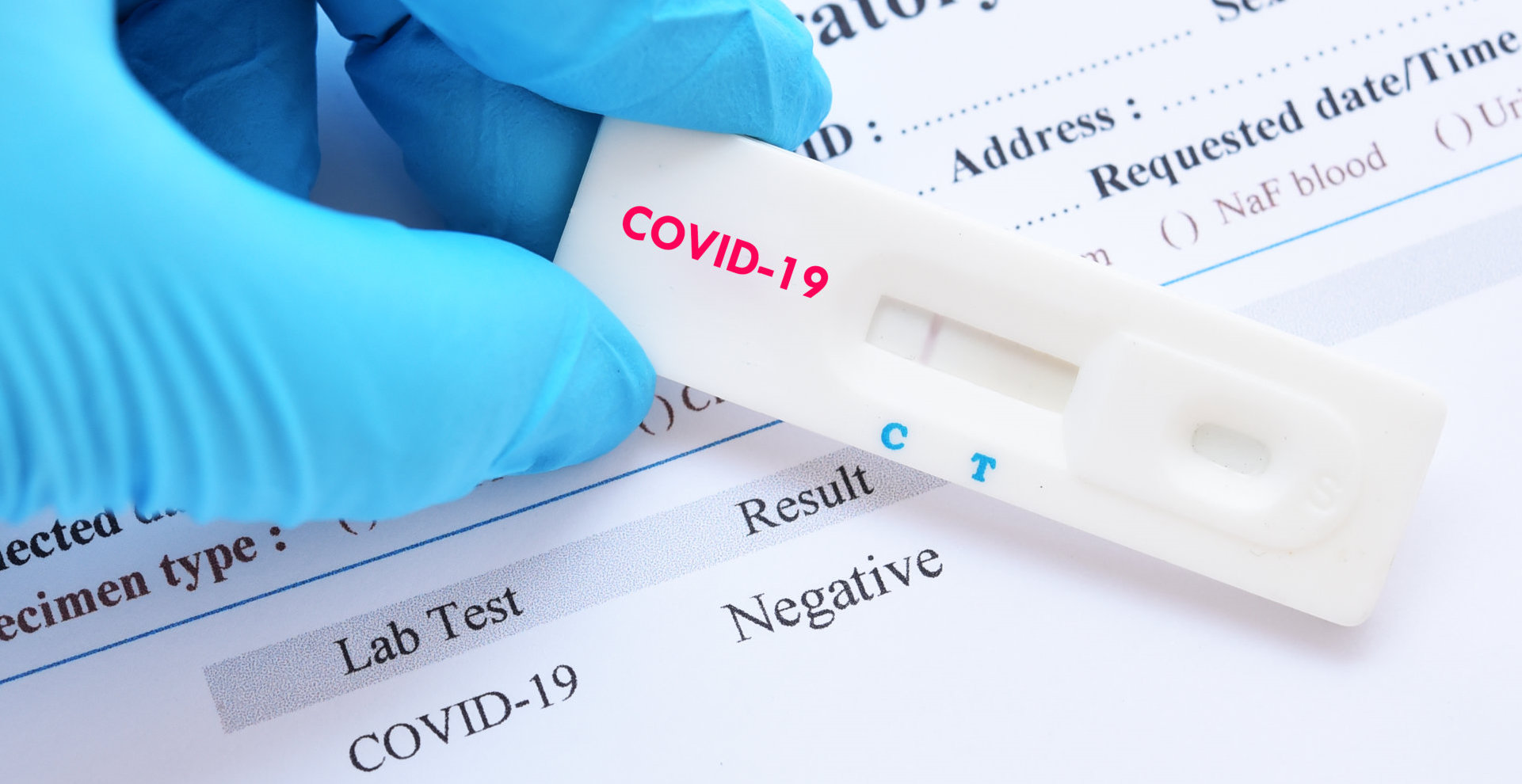 covid 19 test result